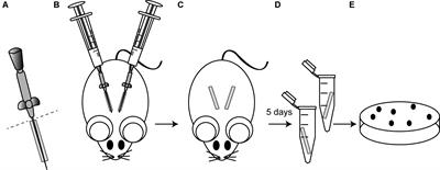 A Systematic Evaluation of the Two-Component Systems Network Reveals That ArlRS Is a Key Regulator of Catheter Colonization by Staphylococcus aureus